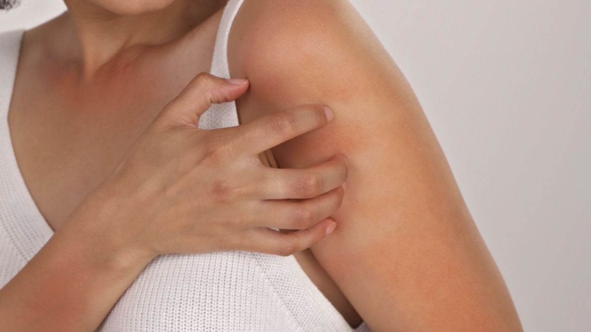 Dermatologist Appointment for Severe Itching and Inflamed Skin in McLean, Virginia